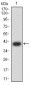 Mouse Monoclonal Antibody to CD274
